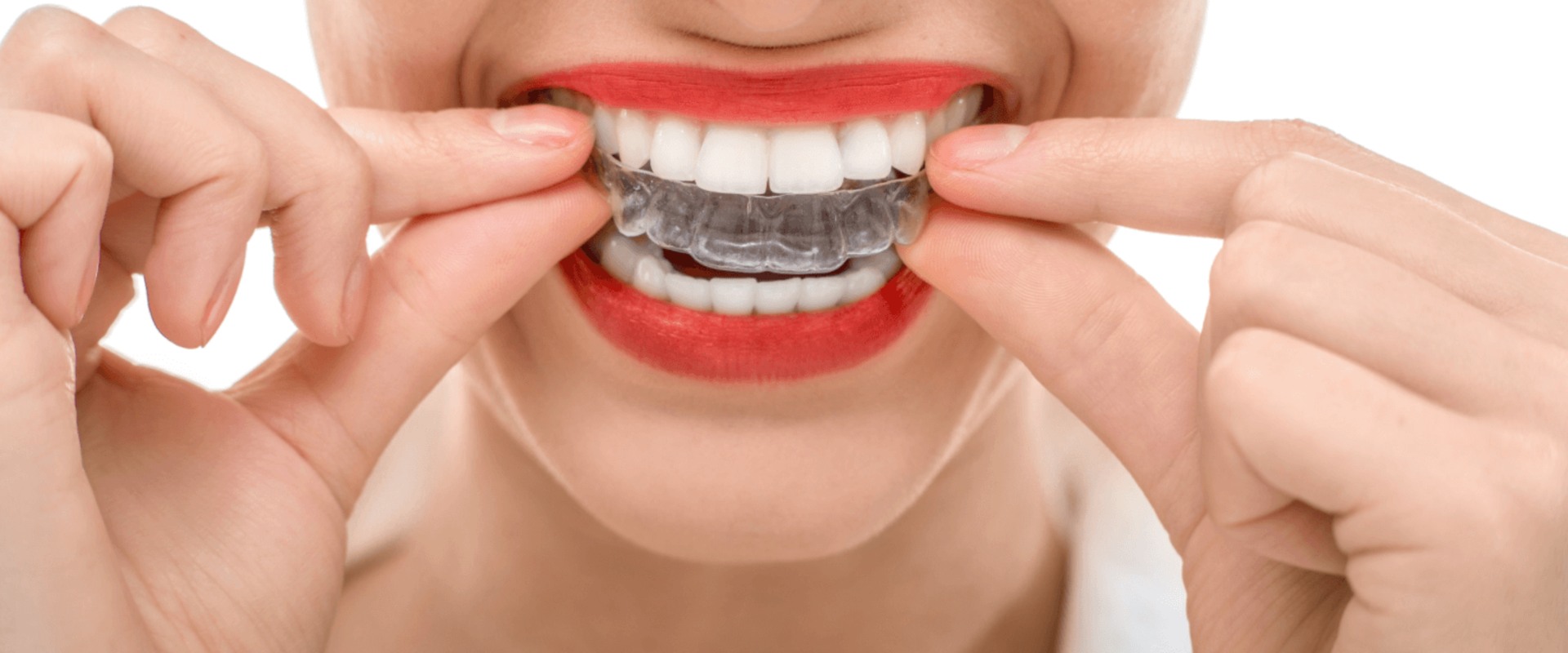 What are the Different Levels of Invisalign Certification?