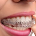 What is the Difference Between an Orthodontist and an Invisalign Dentist?