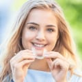 What You Need To Know Before Visiting An Invisalign Dentist In Albany: A Patient's Guide