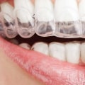 Straighten Your Teeth In Style: What Your Invisalign Dentist Can Do For You In Boerne, TX