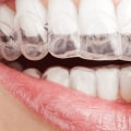 Is Invisalign a Good Option for Kids? - An Expert's Perspective