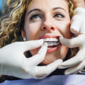 Get A Perfect Smile With Invisalign Treatment From A Skilled Dentist In Spring, TX