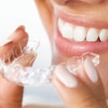 Straight To The Point: Finding Your Invisalign Dentist In Gainesville, VA