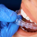How An Invisalign Dentist Can Help You Weigh The True Cost Of Braces In Summerville