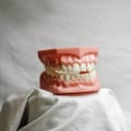 Discover Top Invisalign Dentist Services in Somerville