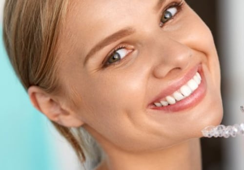 Why An Invisalign Dentist In San Antonio Is The Best Choice For Invisalign Treatment
