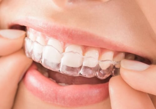 Invisalign Dentists In Dulles, VA: Providing Smiles And Emergency Relief For Kids