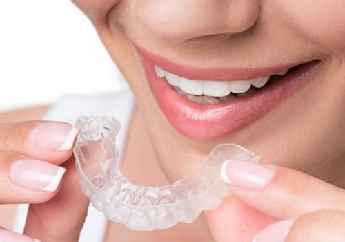 Unlocking Your Smile: Invisalign In Rockville, MD