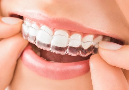 Achieve a Straighter Smile with Invisalign in Seattle