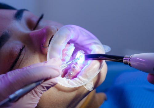 Transform Your Smile with Top-Notch Invisalign Dentists in Fort Walton Beach