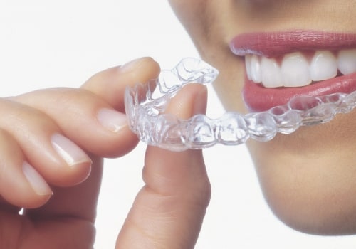 What to Know After Your Child's Invisalign Appointment