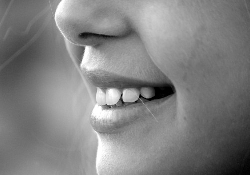 Choosing the Right Invisalign Dentist: 5 Essential Factors to Consider