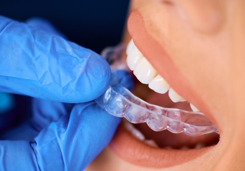 How An Invisalign Dentist Can Help You Weigh The True Cost Of Braces In Summerville