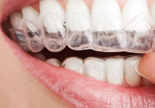 What Results Can You Expect from Invisalign Treatment with a Dentist?